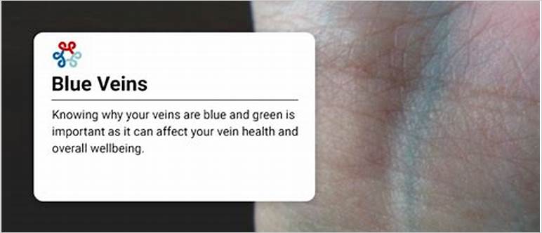 Green or blue veins